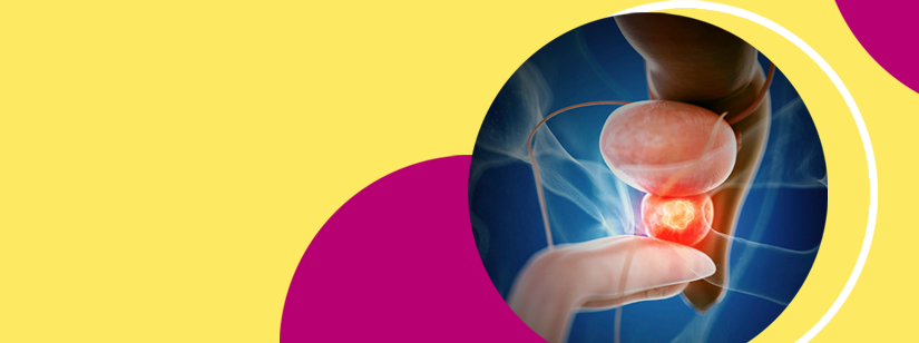 câncer de próstata